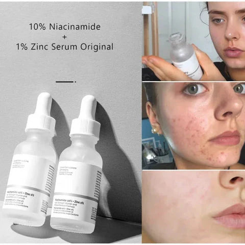 The Ordinary Niacinamide Serum 10% + Zinc 1%